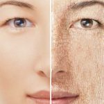 dry-skin-in-winter