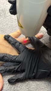 tattoo_removal_kuilsriver