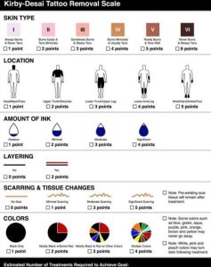kirby_desai_tattoo_removal_calculator