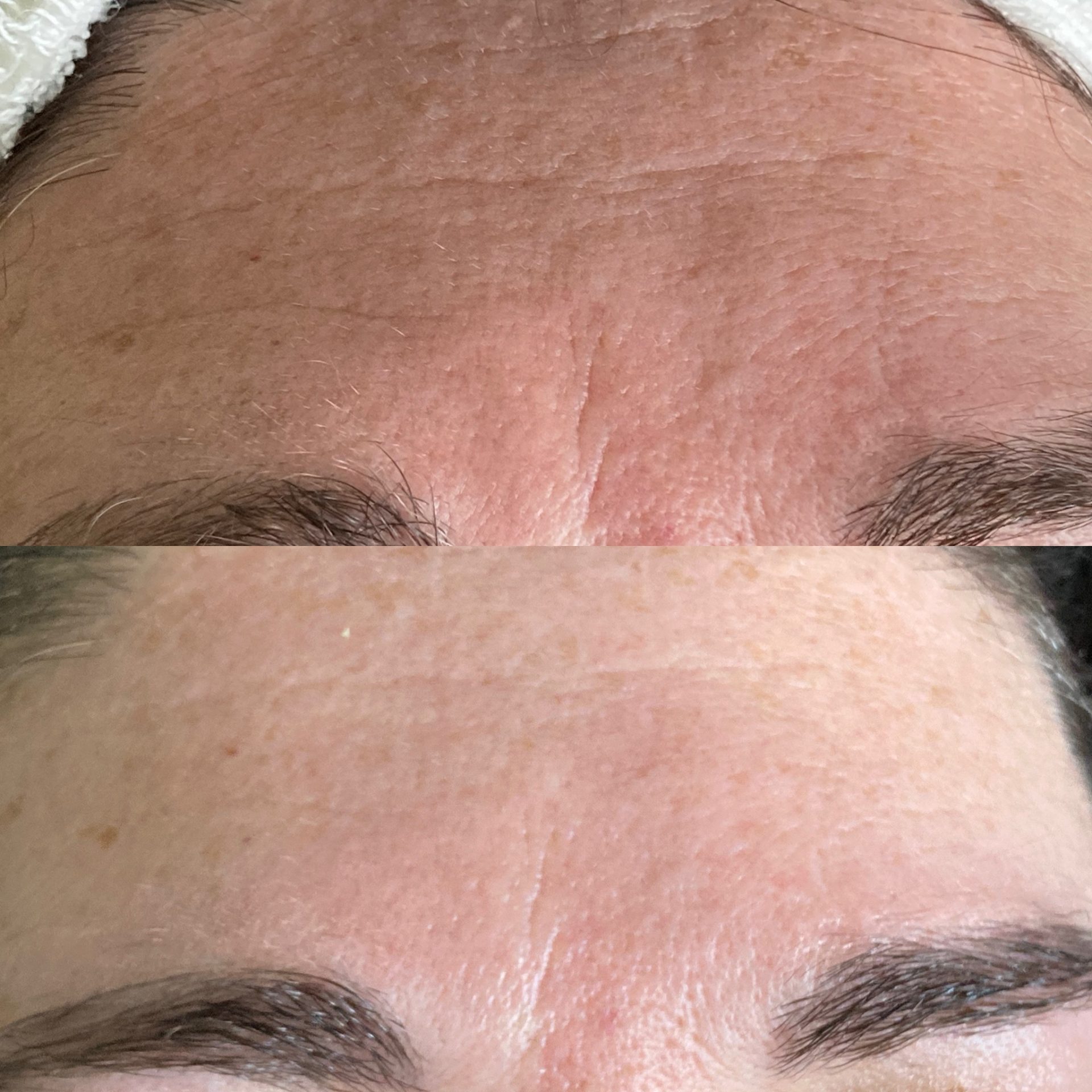 Aesthetic treatment transformation at NDI Aesthetics Cape Town