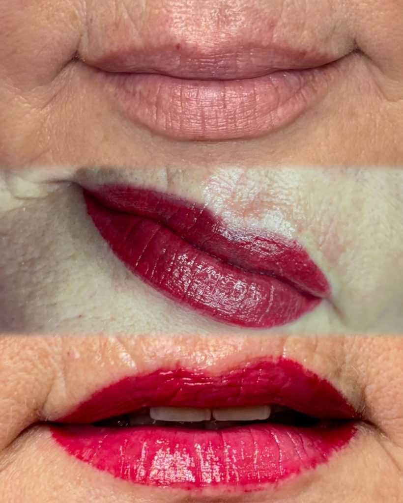 ndi_signature_lipblush_before_after_healed