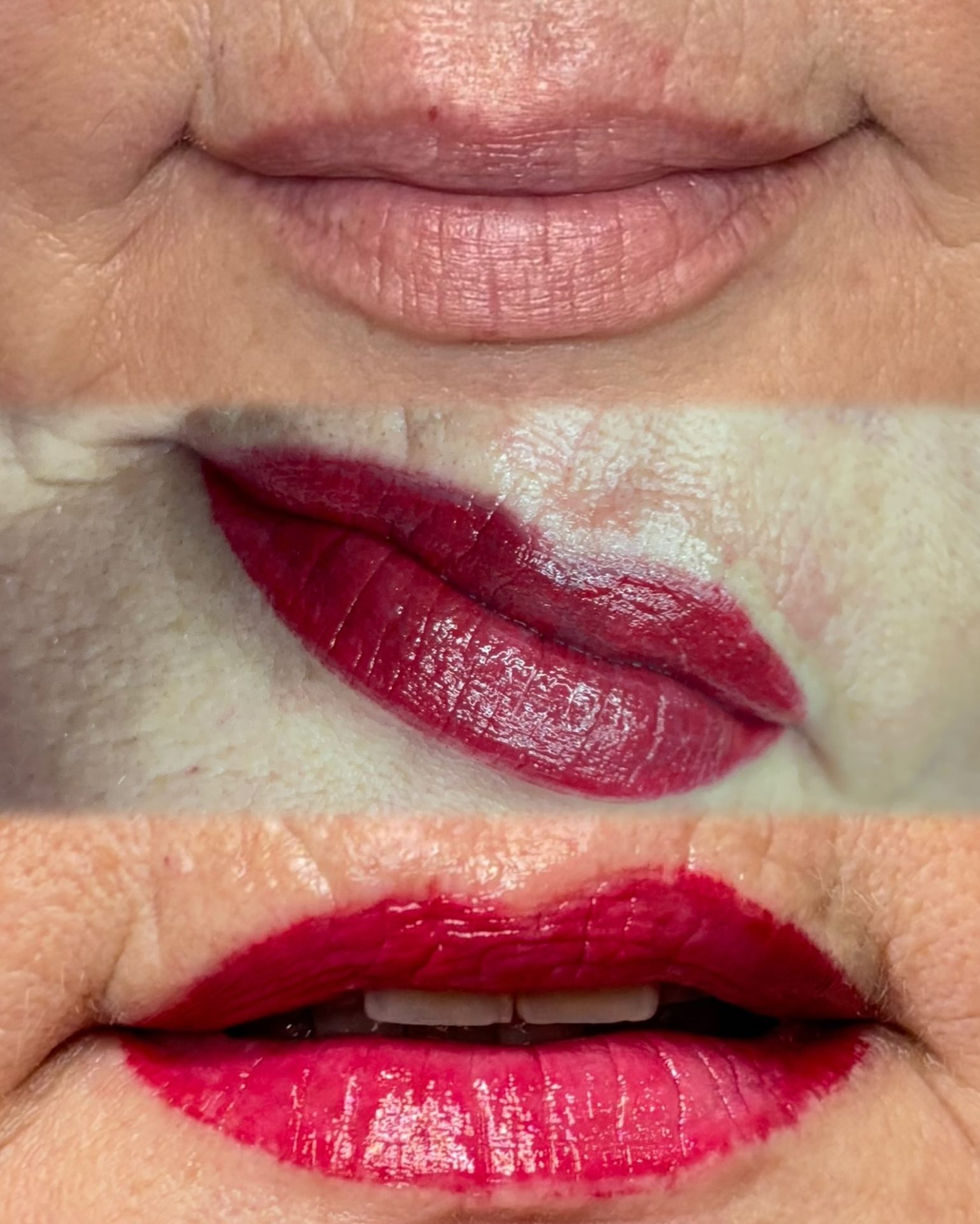 Lipblush  result by NDI Aesthetics Cape Town